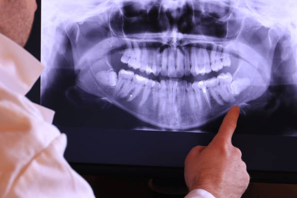 Best Broken or Cracked Tooth Emergency Dentist in Arcola, TX